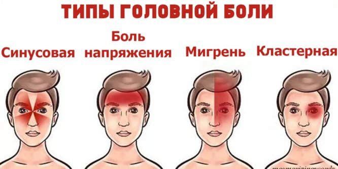 Есть 4 вида головной боли. Вот как правильно избавиться от каждой из них