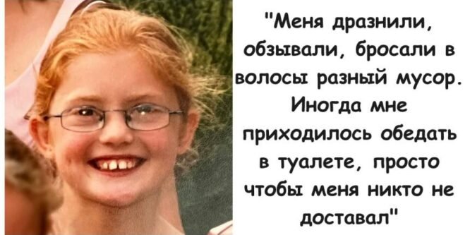 Девочка, которую дразнили в школе за рыжие волосы, выросла и стала Мисс Англии