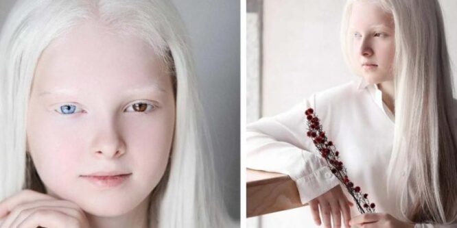 «Чеченка с необычной внешностью стала звездой Интернета»: как живет и чем сегодня занимается 12-летняя Амина